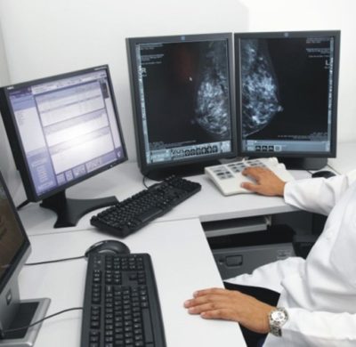 Mamografia da Santa Casa agora é digital